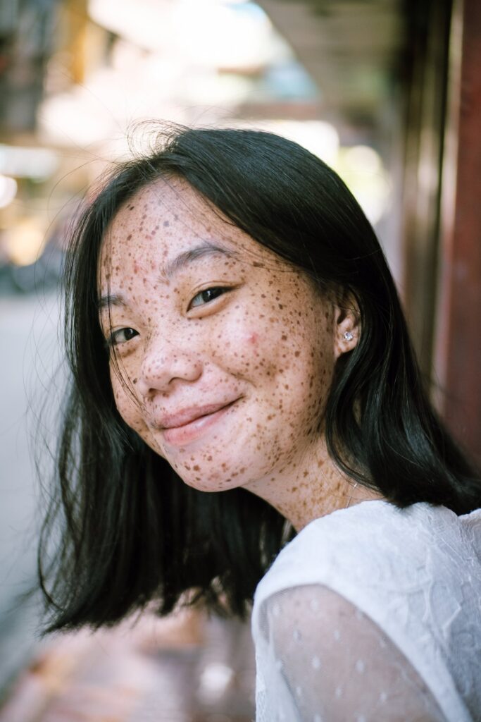 A young woman with freckles smiling softly outdoors